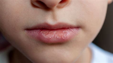 Why Does Saliva Dry Out Your Lips | Sitelip.org