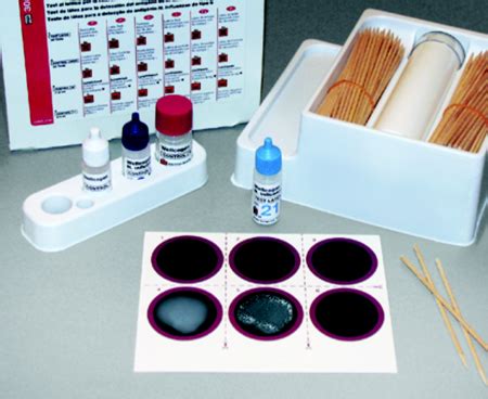 Haemophilus influenzae b detection using Rapid Latex Agglutination Test | Medical Laboratories