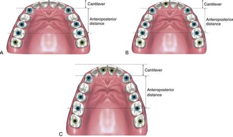 Patient evaluation and treatment planning | Pocket Dentistry