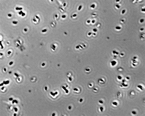 Lactobacillus casei | Viticulture and Enology