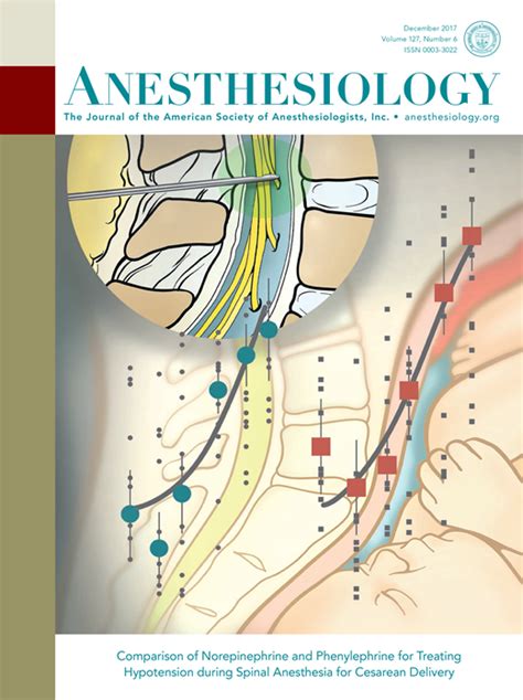 Transfusion-associated Circulatory Overload or Degassing ...