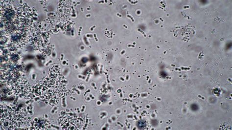 Adjusting the Focus of the Microscope on Lacto Bacteria and Bacilli ...