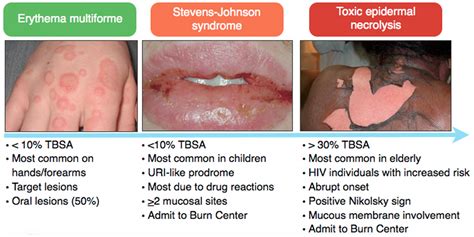 Episode 25 – Skin and Skin Structure Infections – FOAMcast