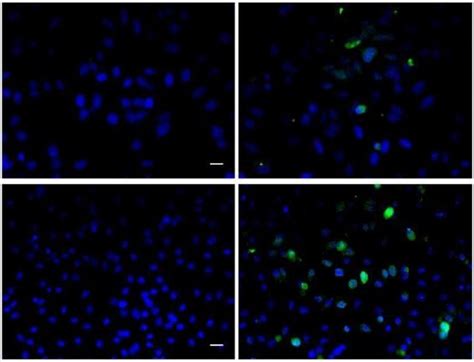 BrdU Polyclonal Antibody – Bioss