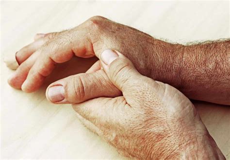 RHEUMATOID ARTHRITIS TREATMENT IN AYURVEDA