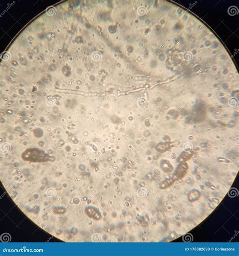 Fungal Spores