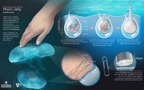 Jellyfish Sting - Symptoms, How To Treat A Jellyfish Sting