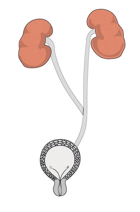 Ureterostomy