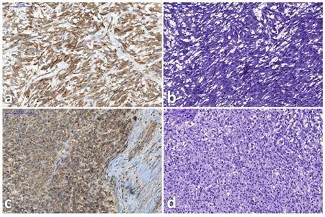 Gastrin-releasing-peptide-receptor immunohistochemistry staining (left... | Download Scientific ...