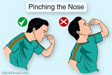 How To Help A Nosebleed - Gameclass18