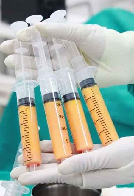 Fat Injections – Al Waslaesthetic