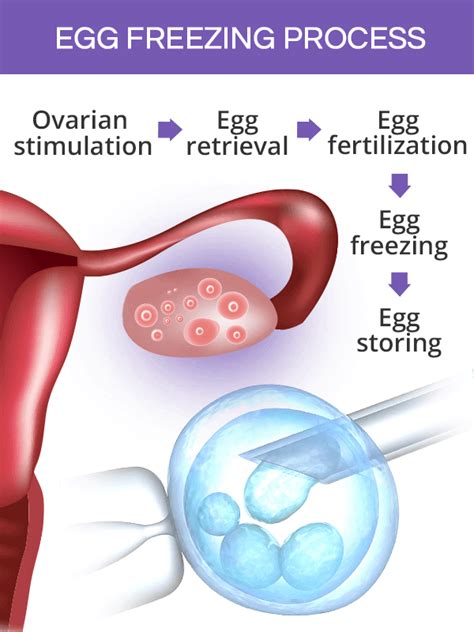 Freezing Eggs | SheCares