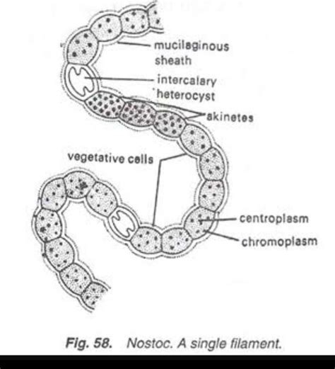 Nostoc Under Microscope Labelled