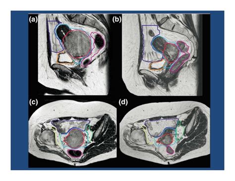 Physical and clinical aspects of brachytherapy