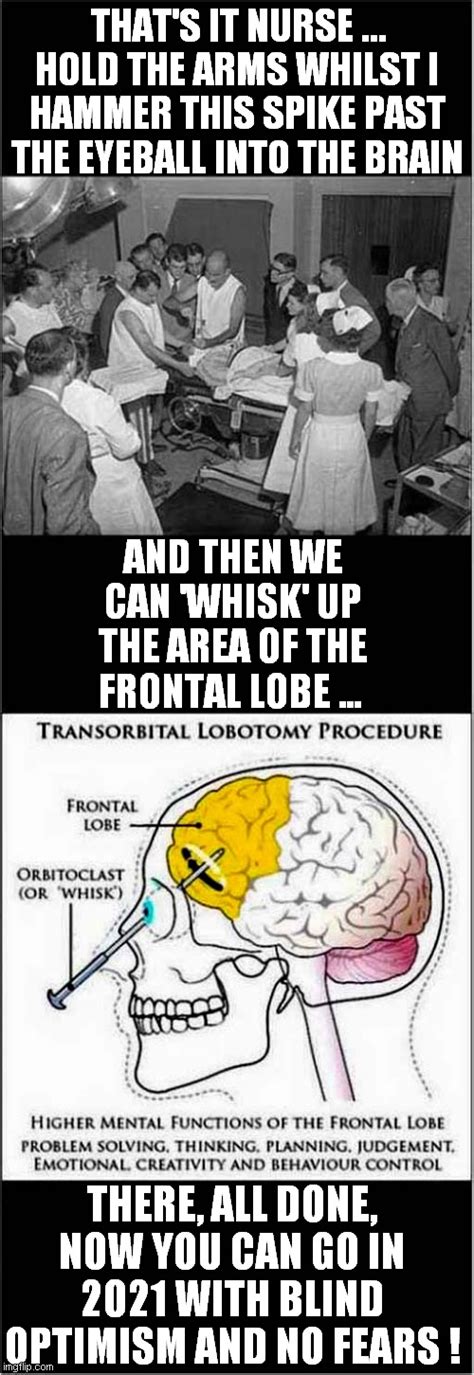 Lobotomy Solution To 2021 Fears - Imgflip