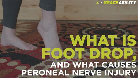 What Is Foot Drop (and What Causes This Peroneal Nerve Injury)?