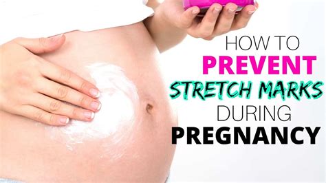 How To Prevent Stretch Marks During Pregnancy