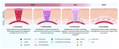 Wound healing process phases. 1. Hemostasis. Rupture of the veins... | Download Scientific Diagram