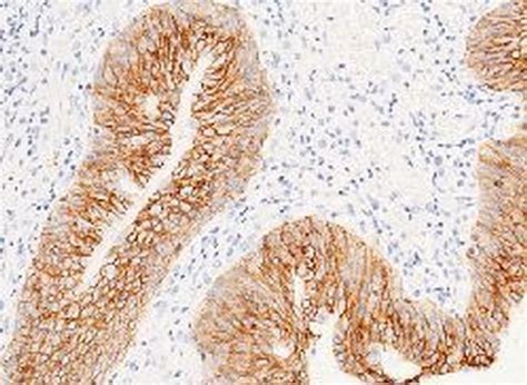 EpCAM Antibody (MA5-29246)