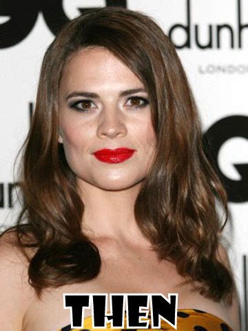 Hayley Atwell Plastic Surgery Before and After Nose Job