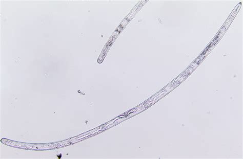 Understanding Nematodes | Microscopic worms friend & foe| joe gardener®