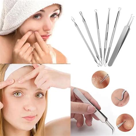 6Pcs Blackhead Remover Tool Kit Whitehead Pimple Acne Blemish Comedone Extractor acne removal ...