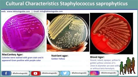 Staphylococcus Bacterial Infection Lab Diagnosis Morphology Culture ...