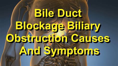 Bile Duct Blockage: Biliary Obstruction Causes and Symptoms - YouTube