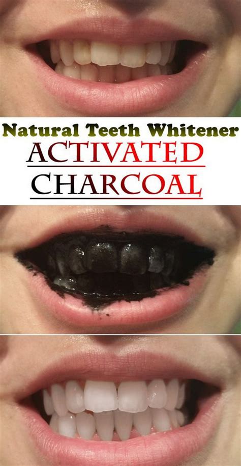 15 Natural Ways to Whiten Your Teeth: Homemade Teeth Whiteners - Just ...