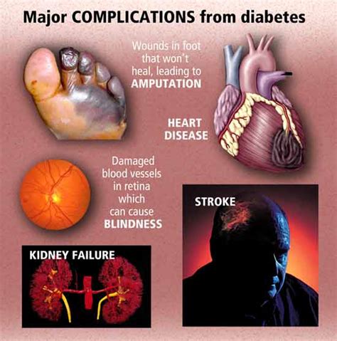 DIABETES and HEALTH | Strive For Good Health