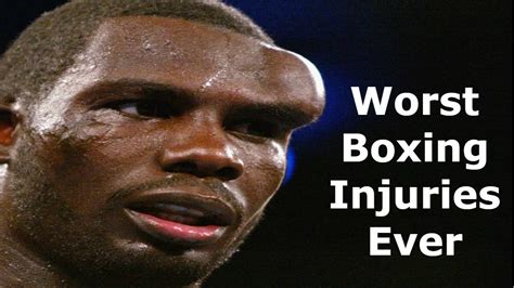 WORST Boxing injuries EVER - YouTube