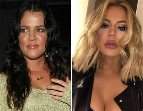 Khloé Kardashian Before and After: See Her Complete Transformation!