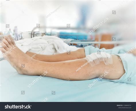 Knee Surgery Medical Treatment Knee Injuries Stock Photo 1238849731 ...