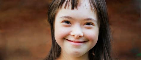 Gerber Baby Inspires Down Syndrome Abortion Bans Across The U.S. | The Daily Caller