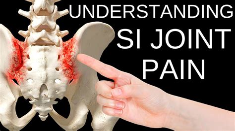 Simple Solutions to Sacroiliac SI Joint Pain - YouTube