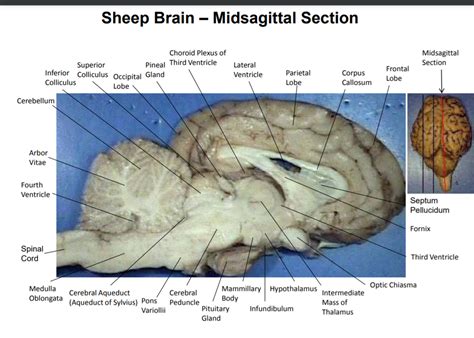 Midsagittal Sheep Brain Diagram | Quizlet