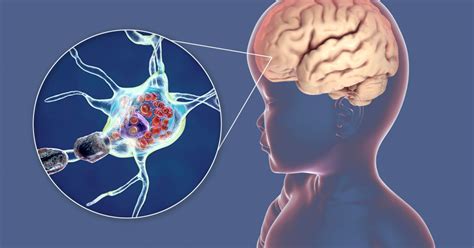 Lysosomal Storage Diseases : Types, Causes, Symptoms and Treatment