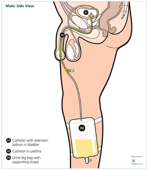 how often should a catheter bag be changed - Style Guru: Fashion, Glitz, Glamour, Style unplugged