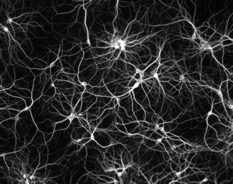 Le cerveau en images. | Neurone, Le cerveau, Réseau humain