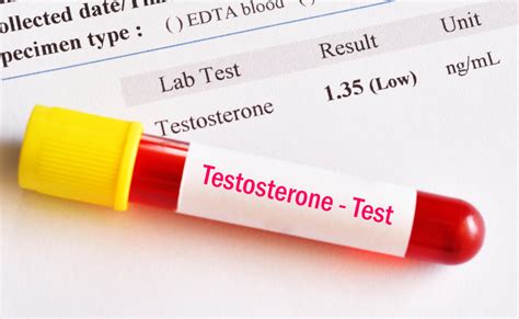 How Do I Test My Testosterone Level? - Male UltraCore Blog