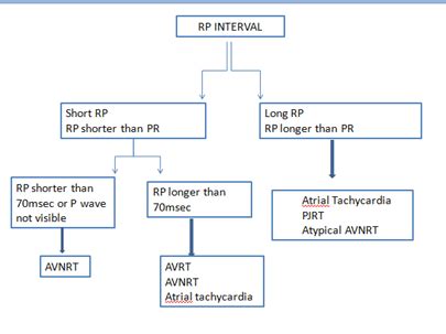 Differentiation of SVT based on RP interval | Download Scientific Diagram