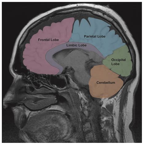 Brain Lobe Anatomy Mri