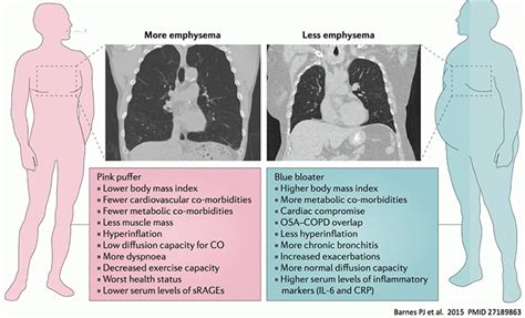 PulmCrit - Optimizing the respiratory drive to avoid failure