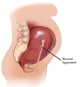 Round Ligament Pain: Why it Occurs & How to Mitigate It - ProNatal Fitness