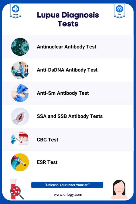 6 Common Test to Lupus Diagnosis: A User-Friendly Guide - Drlogy