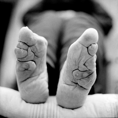 Foot Binding - Sports and Structural Podiatry - Maroochydore