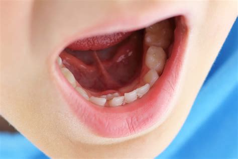 Kids and Shark Teeth, a blog written by Parkcrest Dental