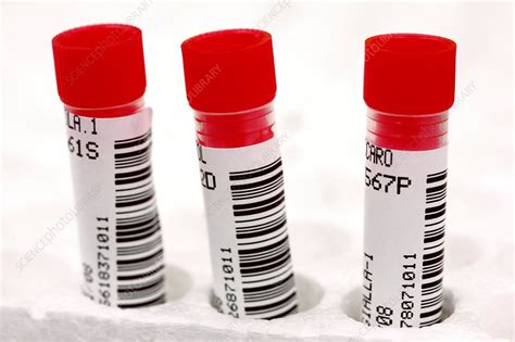 Medical sample tubes - Stock Image - F001/3113 - Science Photo Library