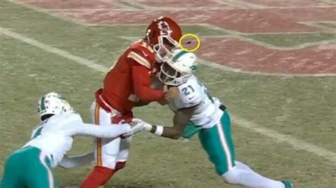 Patrick Mahomes' helmet cracks on hard hit from Dolphins defender