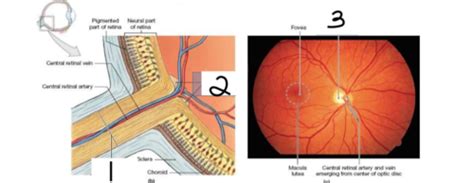 Identify the optic disc, the optic nerve and the blind spot Flashcards ...